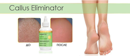 Be natural Средство для удаления натоптышей / Callus Eliminator, 29 мл