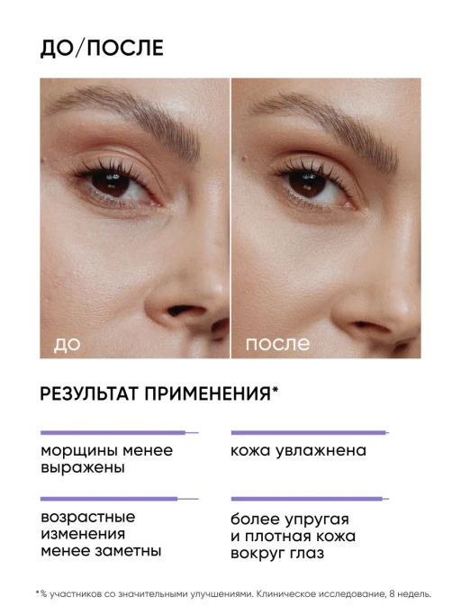 Крем вокруг глаз антивозрастной омолаживающий с ретинолом - Icon skin фото 4