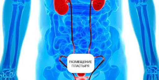 Пластырь от простатита Prostatic Navel Plasters до 2018 . 03 - Elaimei фото 4