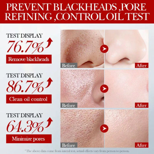 Маска косметическая с экстрактом клубники Сужение пор Для зрелой кожи