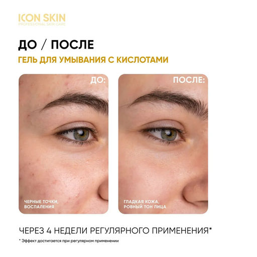 Гель для умывания обновляющий SOFT RENEW с комплексом 6 кислот 5% AHA+PHA+BHA, 150 мл ICON SKIN  фото 3