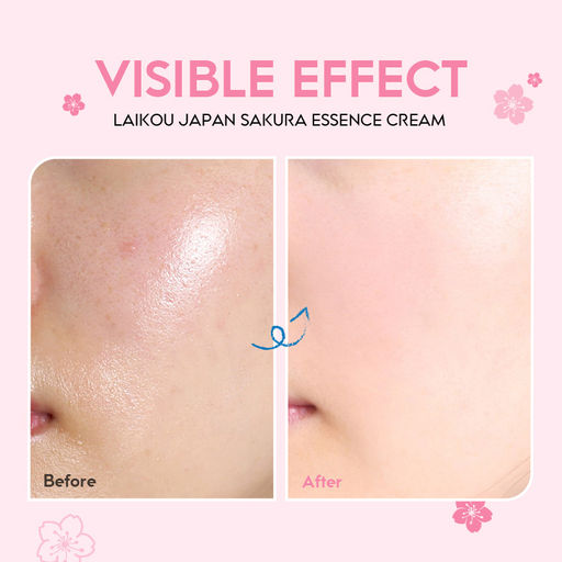 Крем-эссенция с экстрактом японской вишни 25 гр - Nceko фото 3