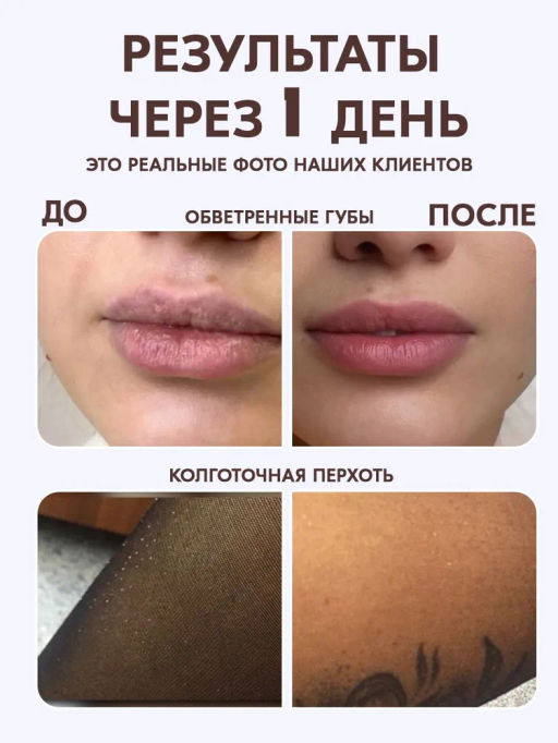 Крем для тела от сухости и трещин Bonimed, 125 мл Boni-0101