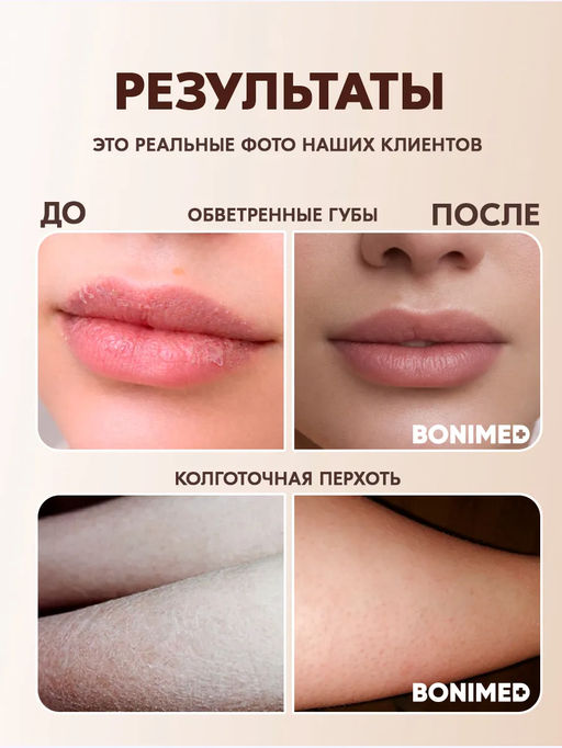 Крем от трещин, сухости и шелушений BONIMED REHABER, 100 гр  фото 8