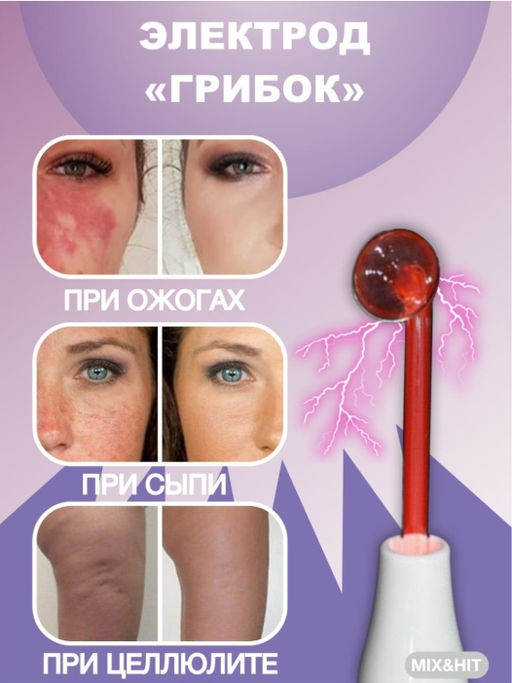 Аппарат Дарсонваль для лица тела и волос - Buro фото 4