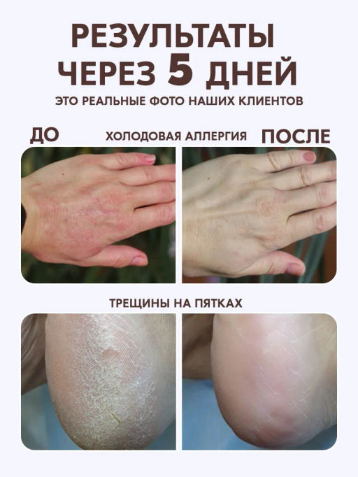 Крем для тела от сухости и трещин Bonimed, 125 мл Boni-0101