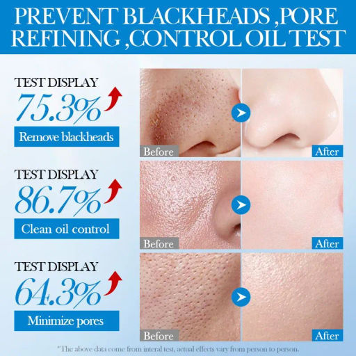 Маска косметическая Сужение пор Для всех типов кожи - Sadoer фото 3