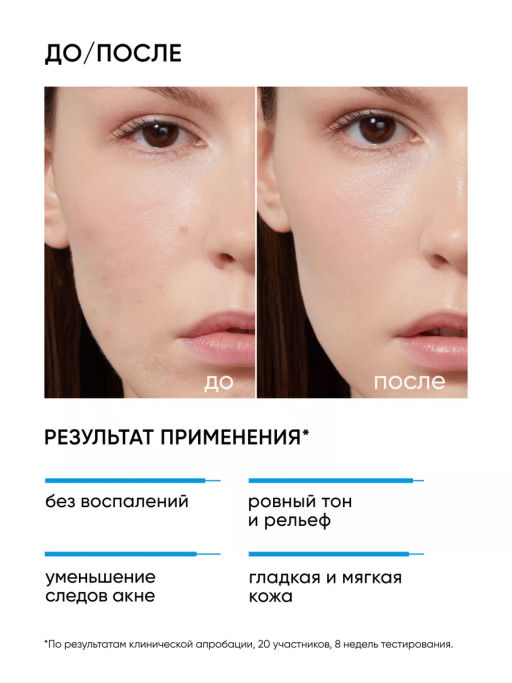 Пилинг для лица 18% от акне и воспалений - Icon skin фото 4