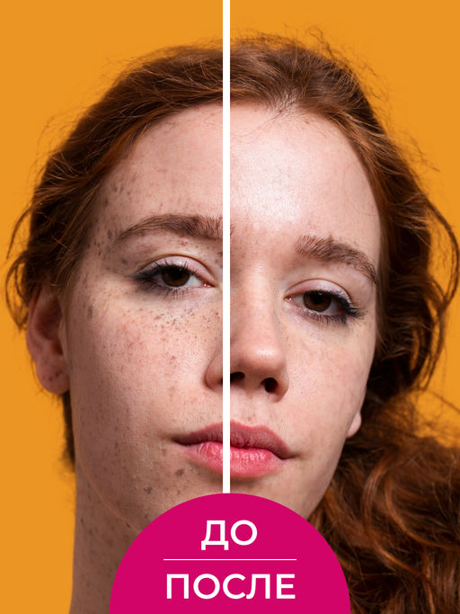 Крем для лица "Против пигментных пятен с SPF 12" SIBERINA