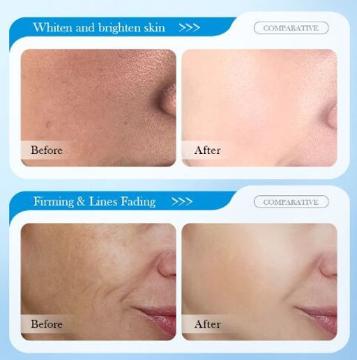 SADOER Увлажняющий крем для лица и шеи с гиалуроновой кислотой 8D , 30 гр  фото 3