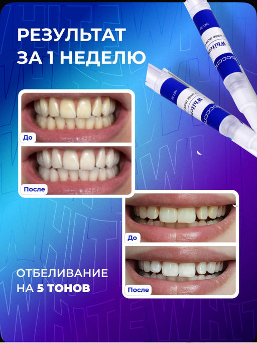 Карандаш для отбеливания зубов - Sadoer фото 8