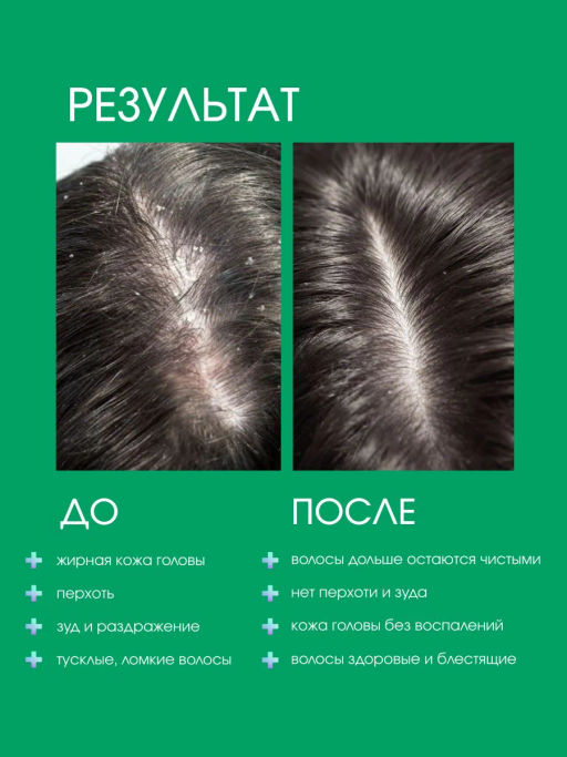 System 4 Терапевтический шампунь №1, 250 мл - Sim sensitive фото 3