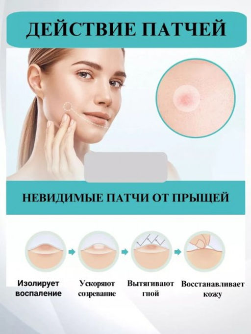 Гидроколлоидные пластыри от прыщей и акне, 40 шт