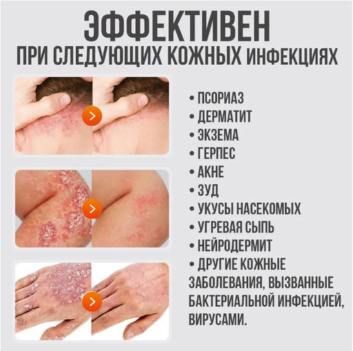 Мазь Сюэнь Ди от любых кожных заболеваний 15гр - Aopen фото 3