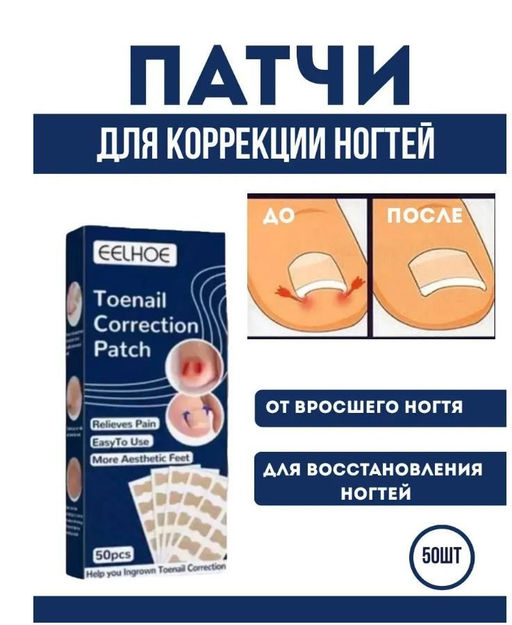 Пластыри наклеки для коррекции вросшего ногтя 50шт