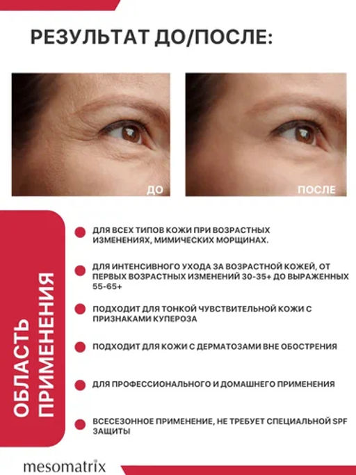 Крем от морщин с пептидами-миорелаксантами MYO RELAX PEPTIDE 30 мл - Mesomatrix фото 2