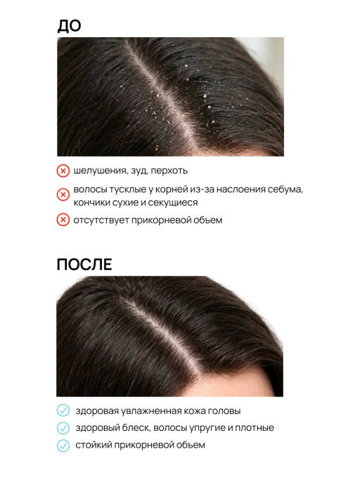 Маска для волос против перхоти 500 мл Meela Meelo  фото 5