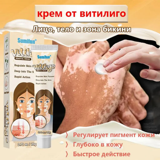 Крем от витилиго против пигментации и белых пятен ,антибактериальный 20гр