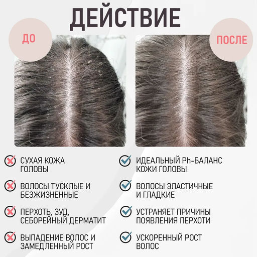 Шампунь от перхоти увлажняющий с цинком и шелком - Btpeel фото 3