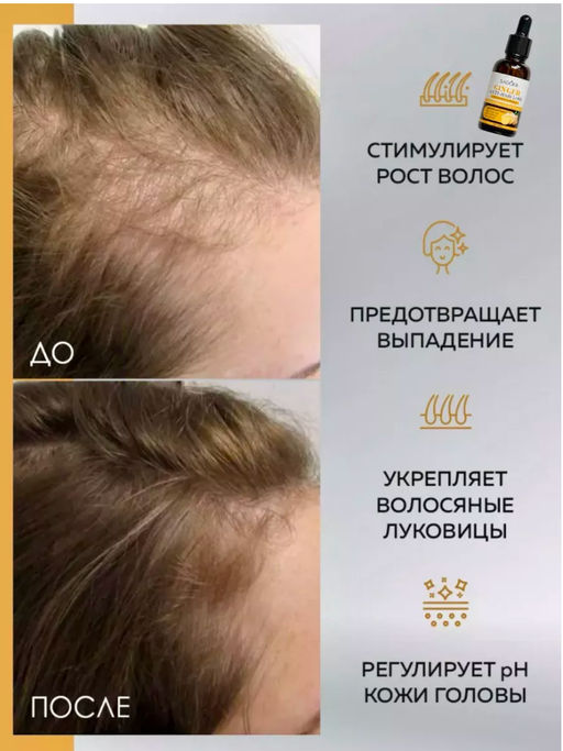 SADOER Сыворотка для волос, 30 мл