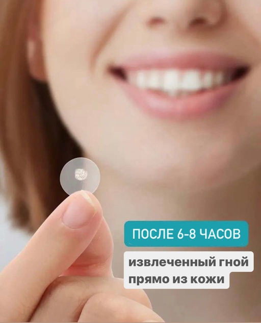 Гидроколлоидные пластыри от прыщей и акне, 40 шт - Sadoer фото 3