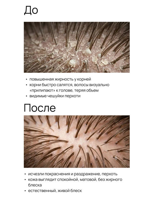 Шампунь кераторегулирующий для волос и кожи головы 400 мл Meela Meelo  фото 5