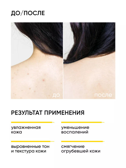 Обновляющий крем для тела с кислотами - Icon skin фото 2
