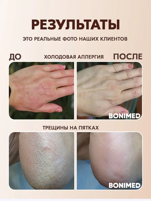 Крем от трещин, сухости и шелушений BONIMED REHABER, 100 гр  фото 9
