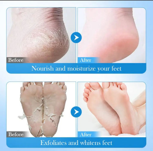 FAYANKOU Маска для ног до колен увлажняющая и питающая с экстрактом авокадо - Sadoer фото 3