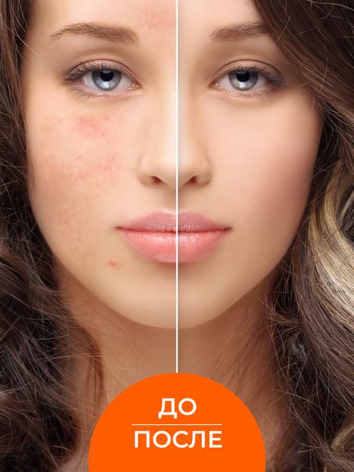 Маска для лица Для проблемной кожи - Siberina фото 8