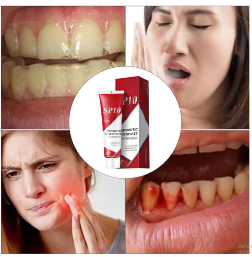 Многофункциональная probiotic Зубная паста SP10 - Family фото 3
