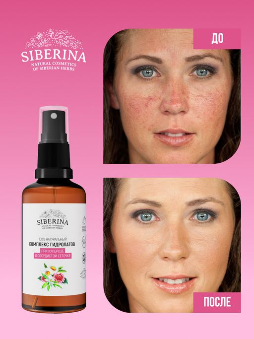 Комплекс гидролатов при куперозе и сосудистой сеточке 50 мл - Siberina фото 6