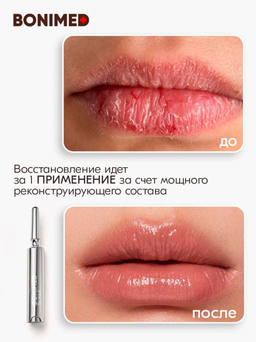 Маска для губ Bonimed AMPULIN, 10 мл Boni-0127