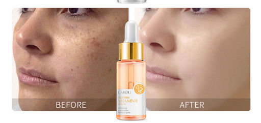 Отбеливающая сыворотка от пигментации с витамином С  17 гр - Laikou фото 3