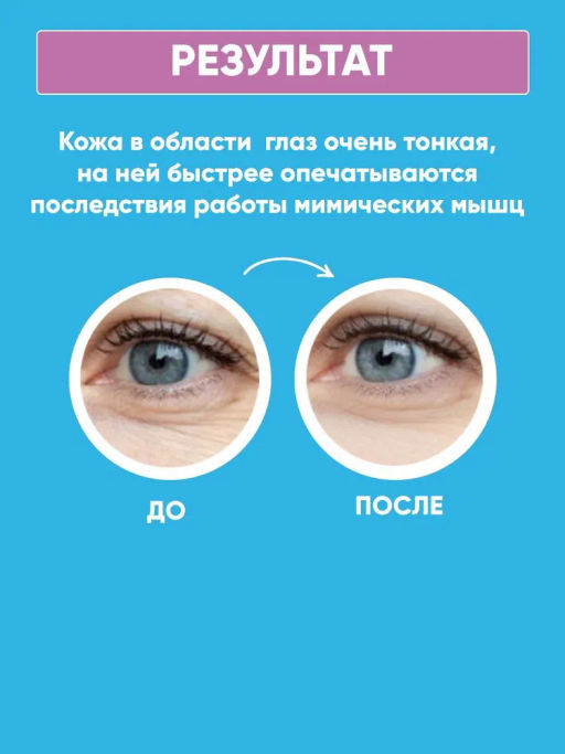 ELIZAVECCA - КРЕМ ДЛЯ ВЕК И ГЛАЗ С ЭКСТРАКТОМ ЛАСТОЧКИНОГО ГНЕЗДА GOLD CF-NEST WHITE BOMB EYE CREAM, 30 ML  фото 7