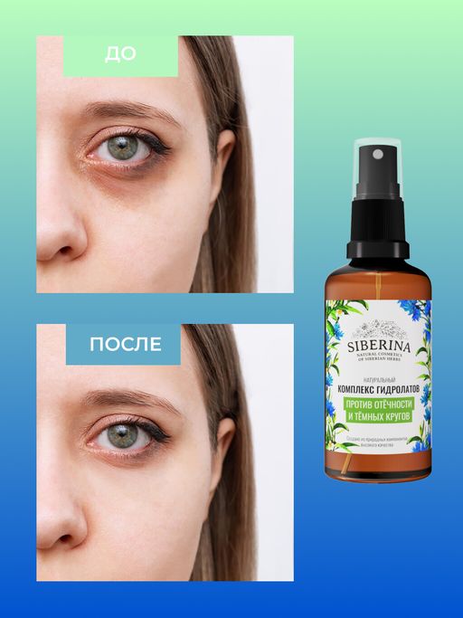 Комплекс гидролатов для зоны вокруг глаз Против отечности и темных кругов - Siberina фото 6