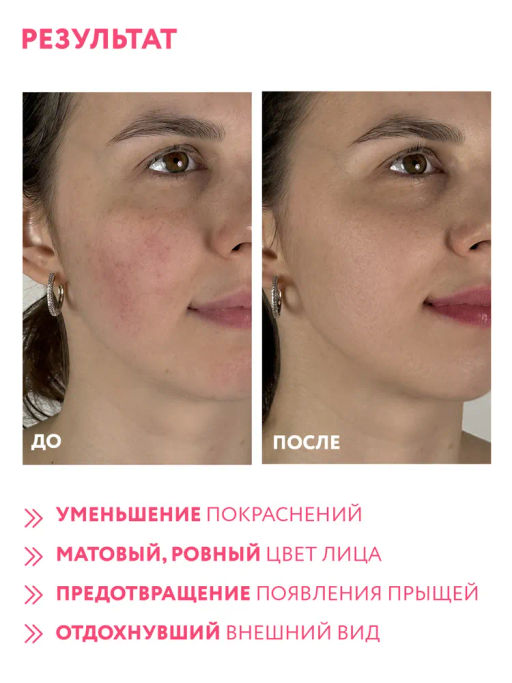 ARAVIA Professional Мультифункциональный SOS-тоник для лица, 150 мл/15