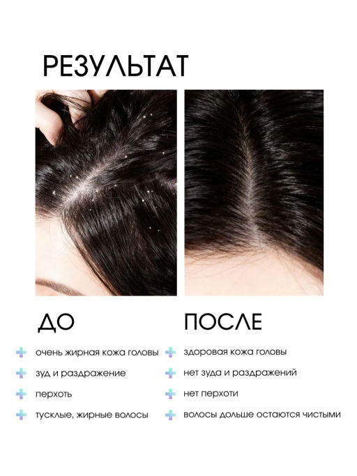 System 4 Терапевтический шампунь №4, 250 мл - Sim sensitive фото 3