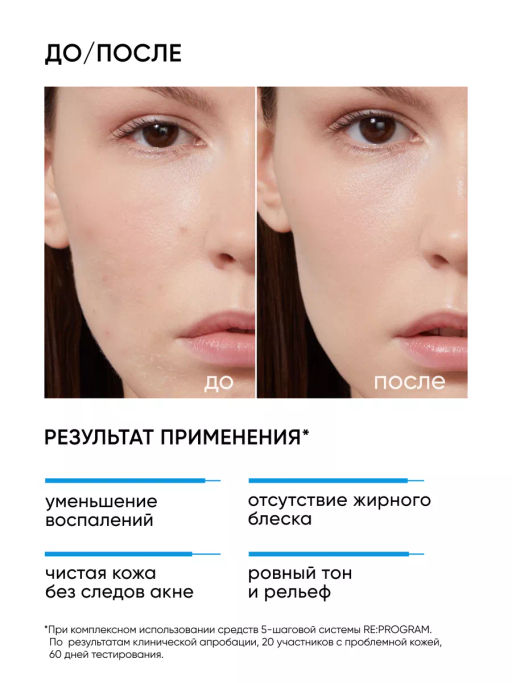Маска для лица очищающая от жирного блеска и акне - Icon skin фото 3