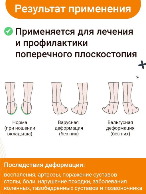 Выкладка поперечного свода Talus 61к