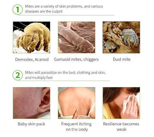 Мазь Aopen от подкожных клещей и вшей для людей и животных 20 мл  фото 2