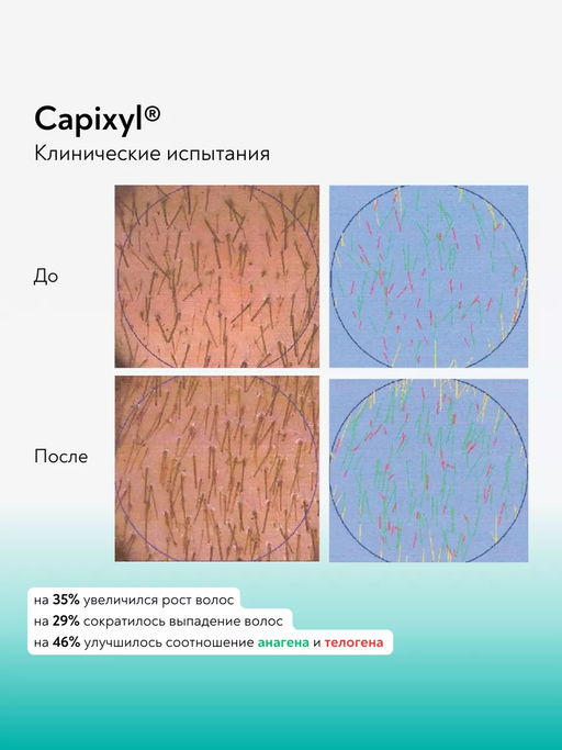 Careprost для ВОЛОС