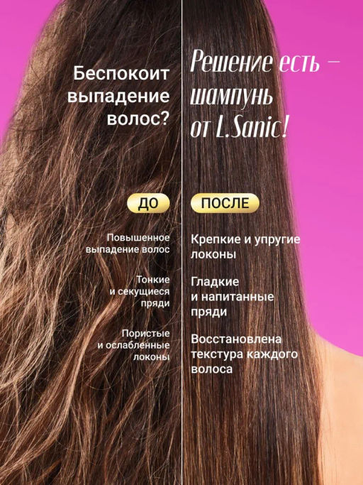 Шампунь от перхоти с кератином, 300мл, L.Sanic  фото 2