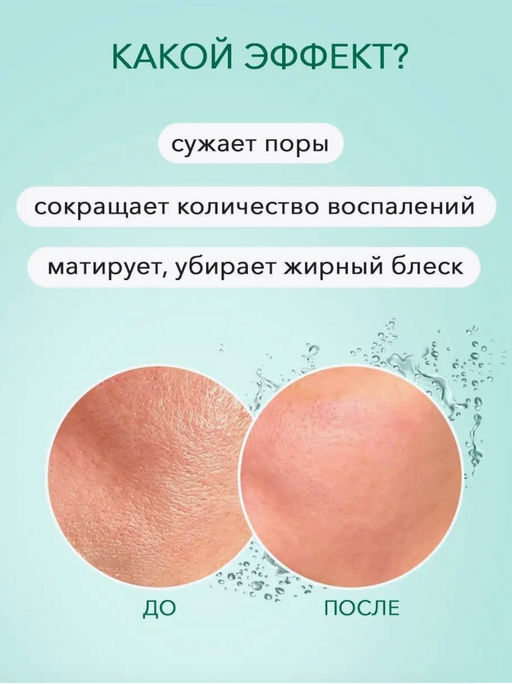 Гель с 15% азелаиновой кислотой, 30 мл - Images фото 7