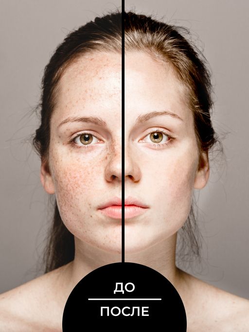 Отбеливающий крем для лица ночной против веснушек, пигментных пятен и постакне SIBERINA