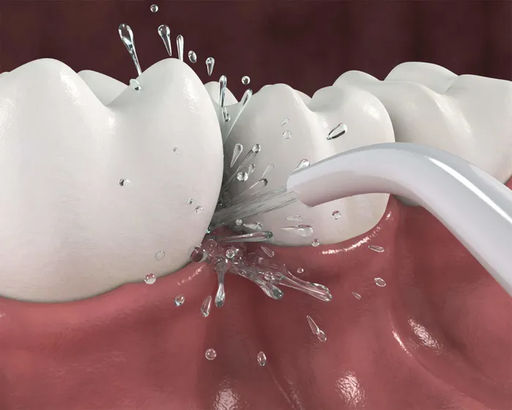 R.O.C.S. PRO Жидкость для Ирригатора, 75 мл ROCS/РОКС  фото 3