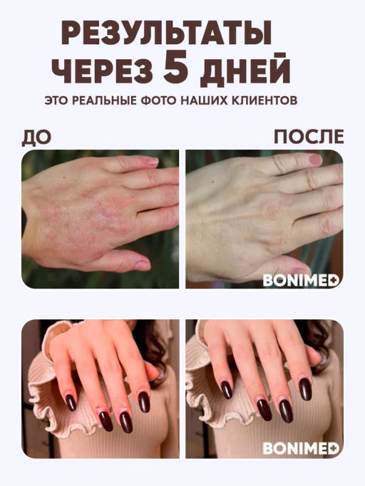 Крем от сухости и трещин на руках Bonimed, 125 мл Boni-0103