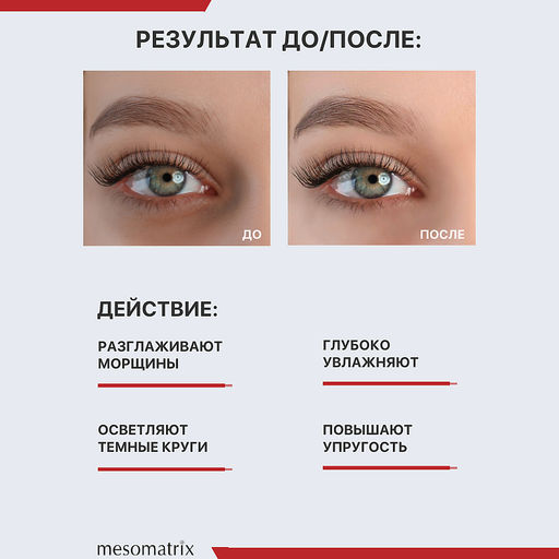 Пептидные патчи для глаз от морщин и отеков EYE LIFT PEPTIDE, 60 шт - Mesomatrix фото 2