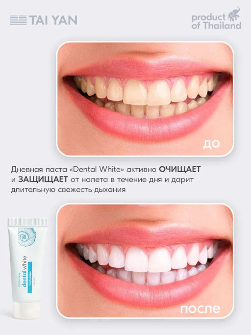 Тревел набор зубных паст 2*10 гр, 111-06 - Bonimed фото 6