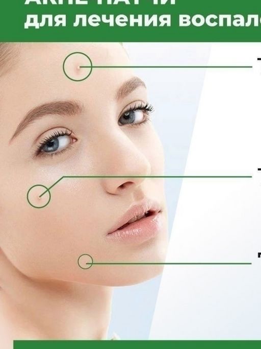 Патчи от прыщей, от акне  -24 шт